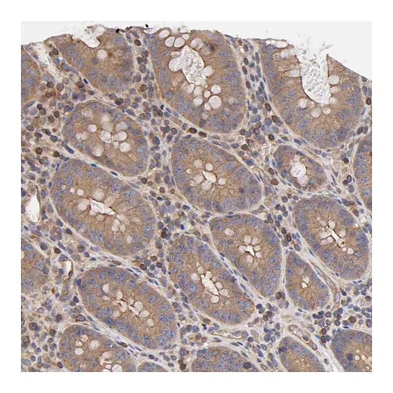 Atlas Antibodies Anti-STRN3 Antibody