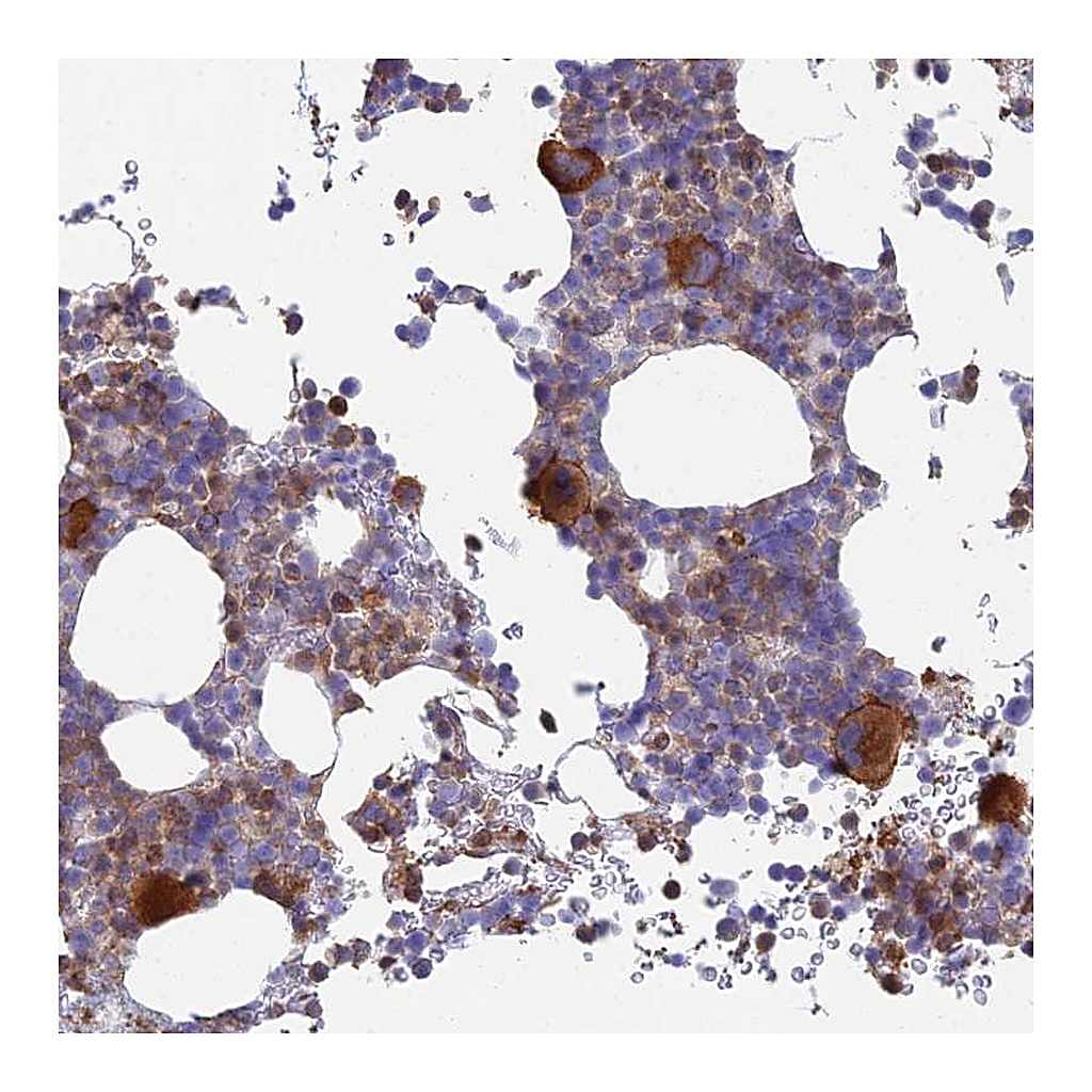 Atlas Antibodies Anti-STRN4 Antibody