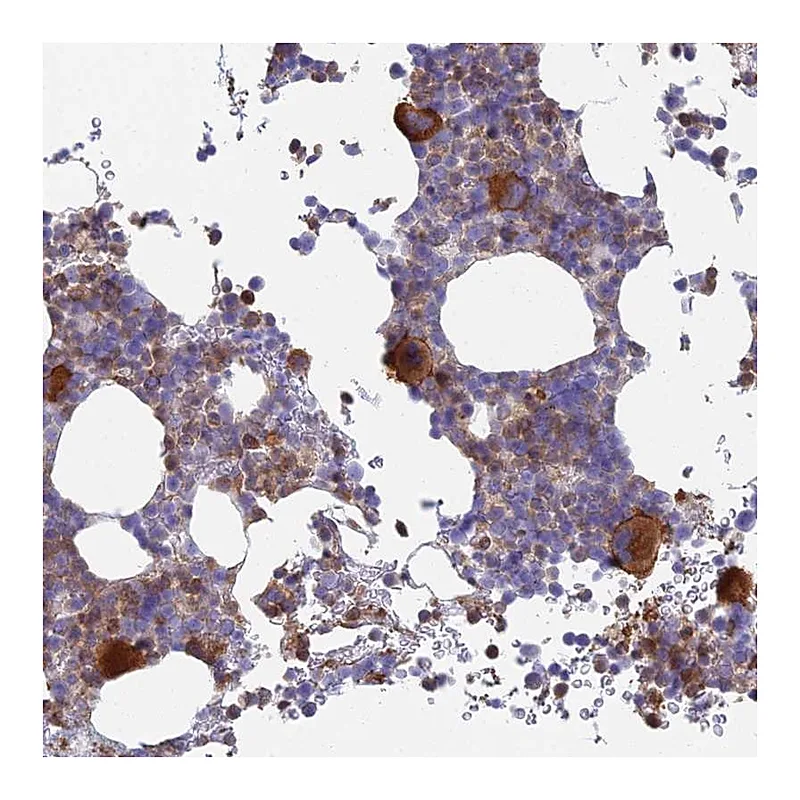 Atlas Antibodies Anti-STRN4 Antibody