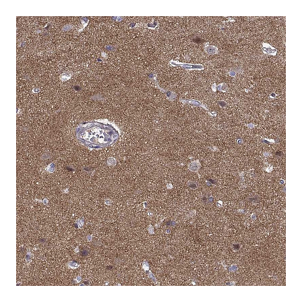Atlas Antibodies Anti-STRC Antibody