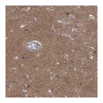 Atlas Antibodies Anti-STRC Antibody