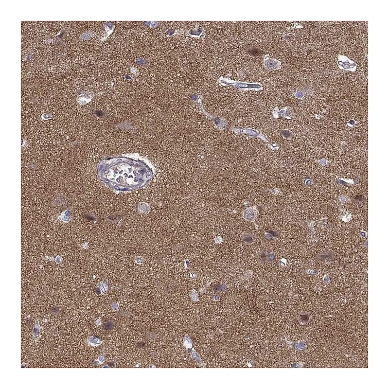 Atlas Antibodies Anti-STRC Antibody