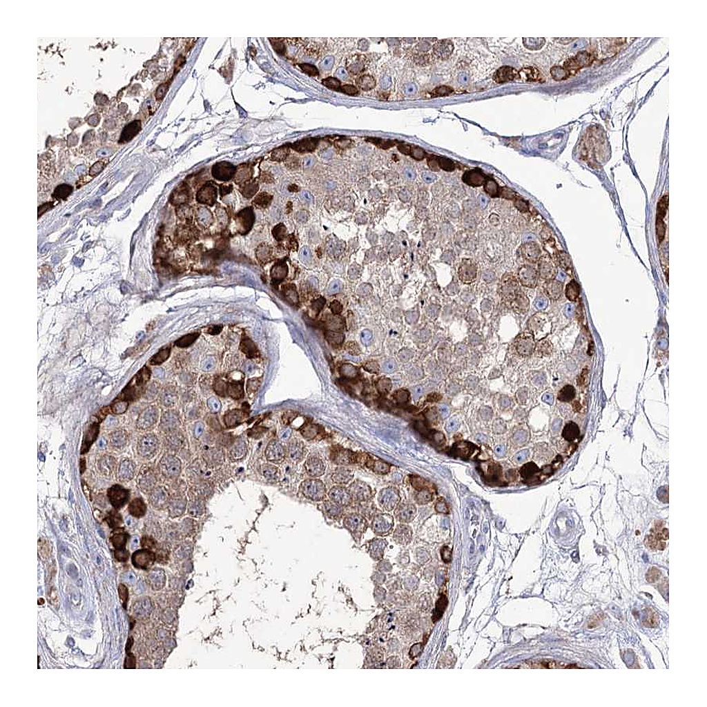 Atlas Antibodies Anti-STT3B Antibody