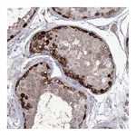 Atlas Antibodies Anti-STT3B Antibody