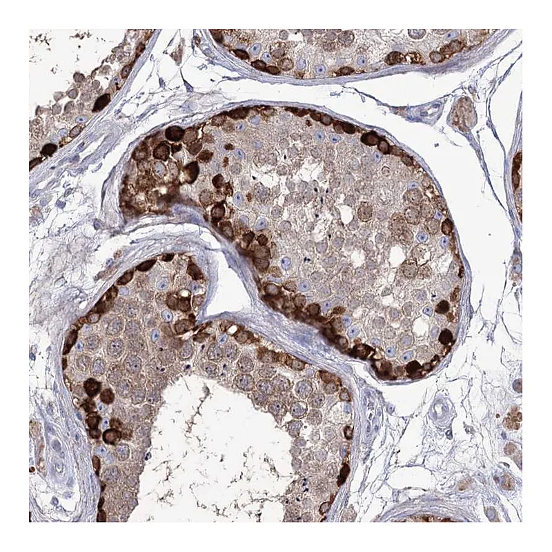 Atlas Antibodies Anti-STT3B Antibody