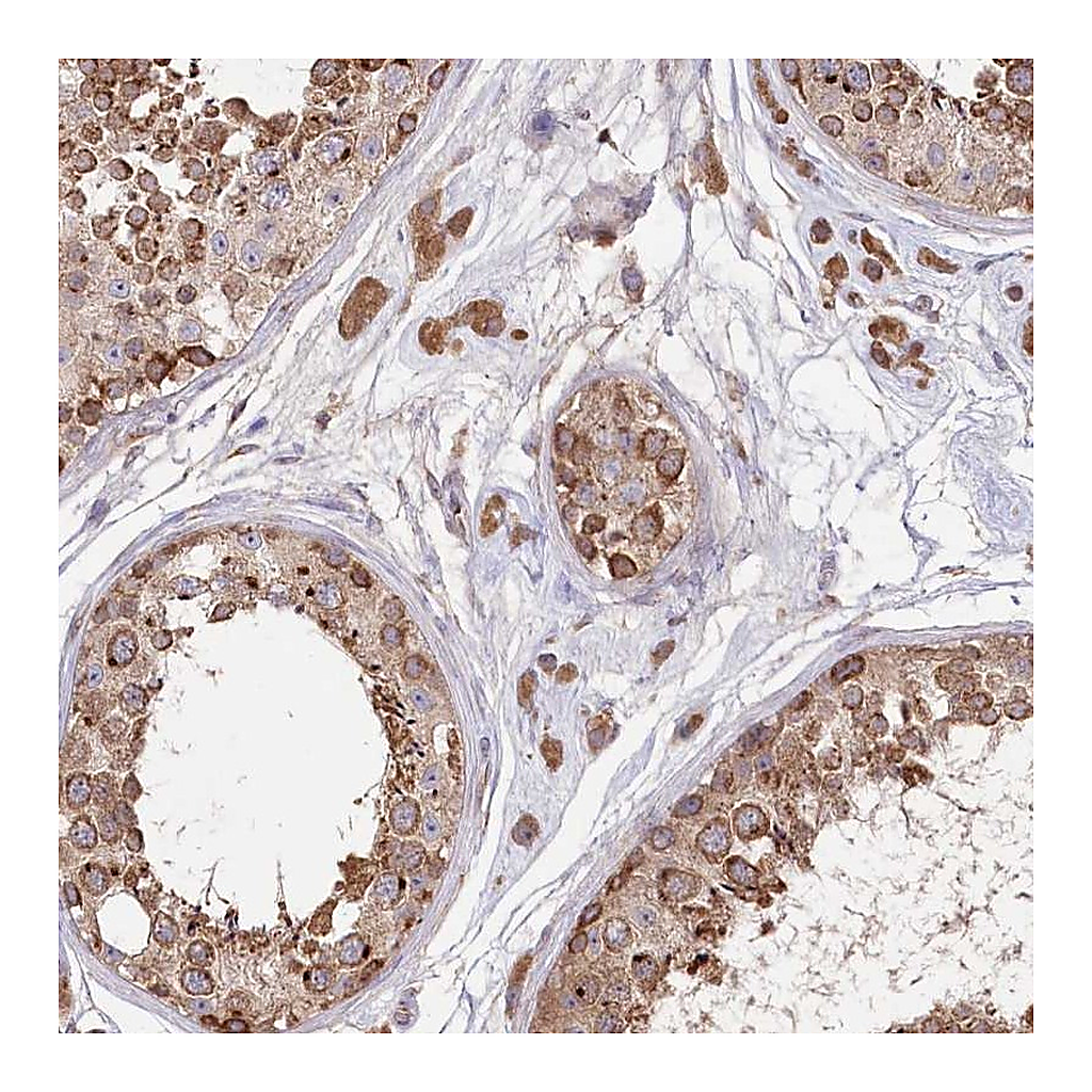 Atlas Antibodies Anti-STT3B Antibody