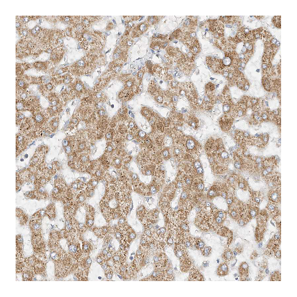 Atlas Antibodies Anti-STT3A Antibody