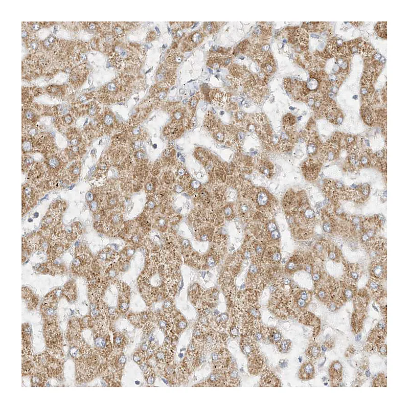 Atlas Antibodies Anti-STT3A Antibody
