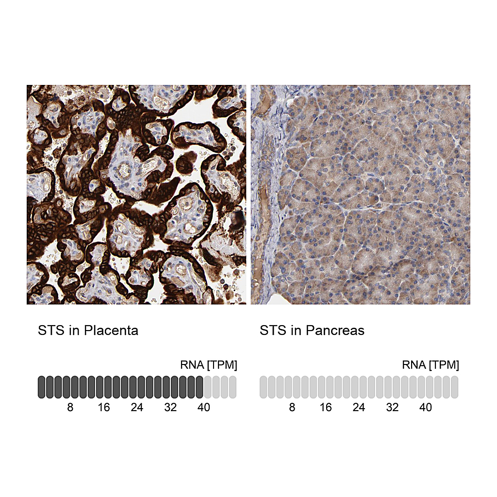 Atlas Antibodies Anti-STS Antibody