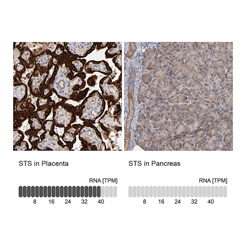 Atlas Antibodies Anti-STS Antibody