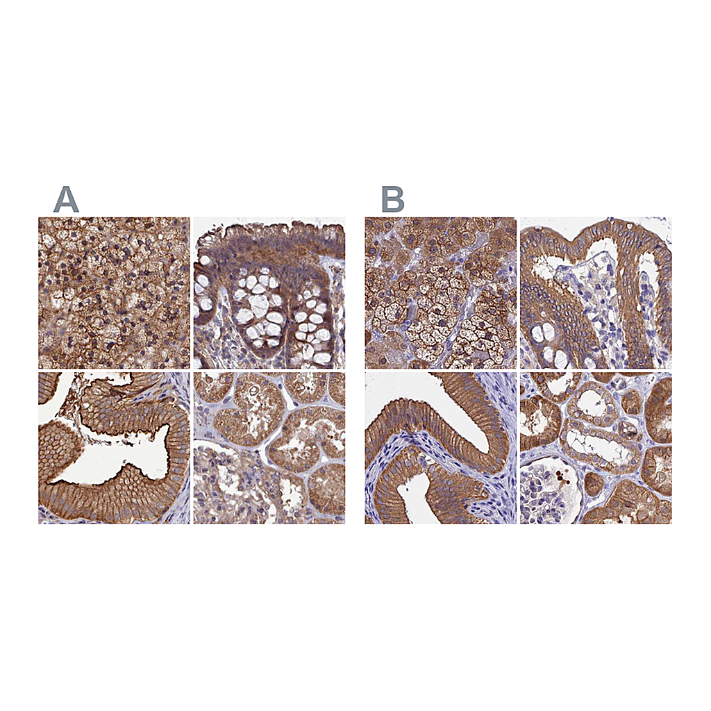 Atlas Antibodies Anti-STUB1 Antibody
