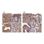 Atlas Antibodies Anti-STUB1 Antibody