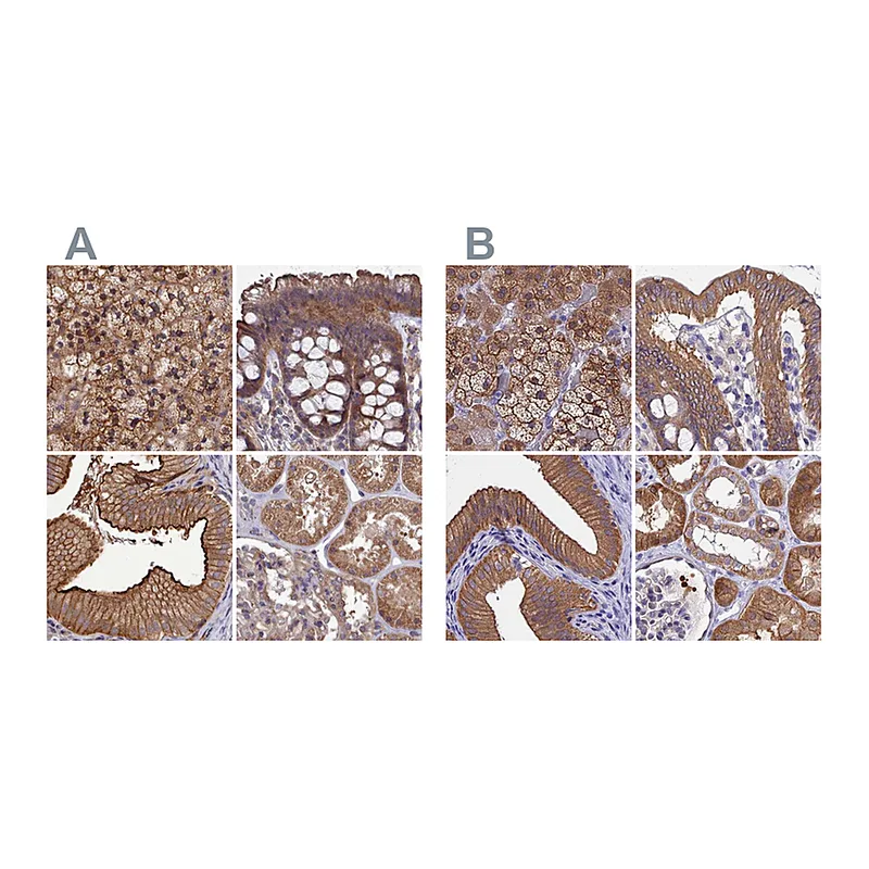 Atlas Antibodies Anti-STUB1 Antibody
