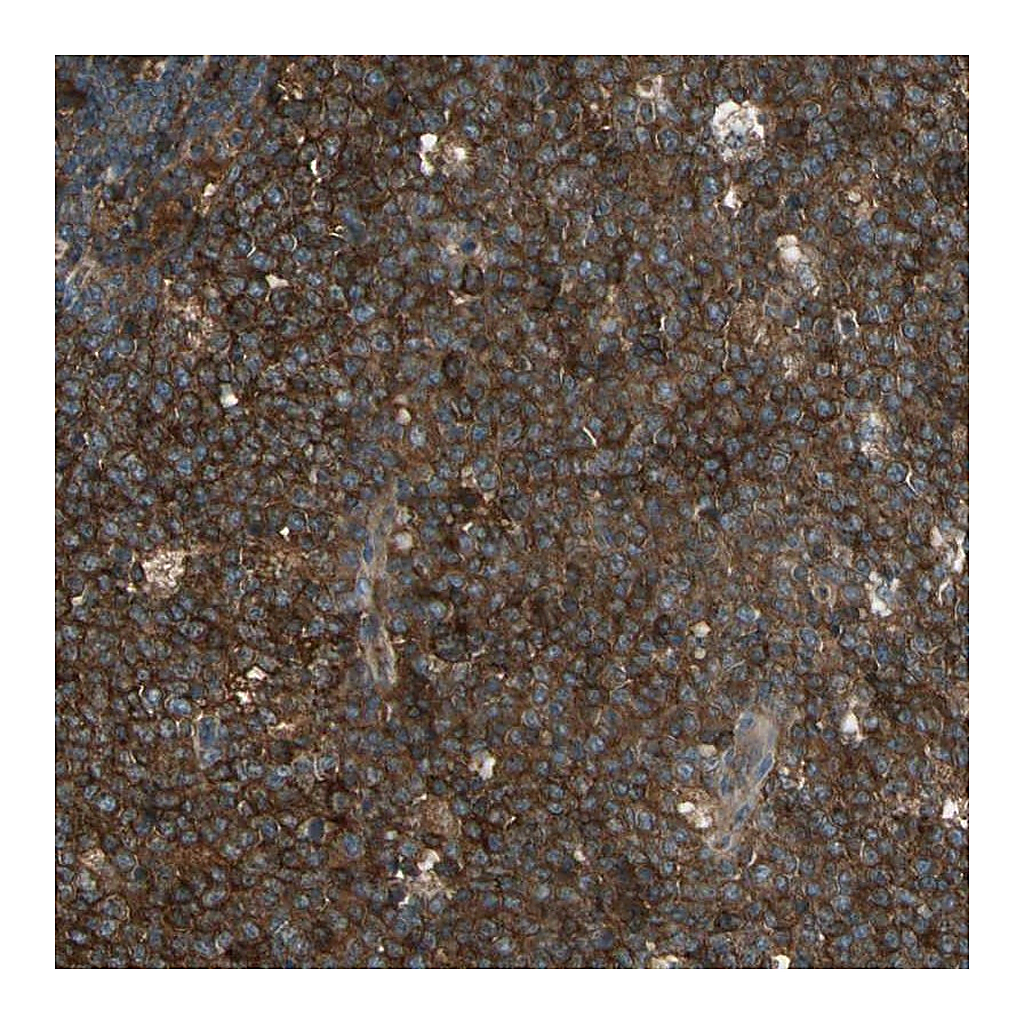 Atlas Antibodies Anti-STX11 Antibody