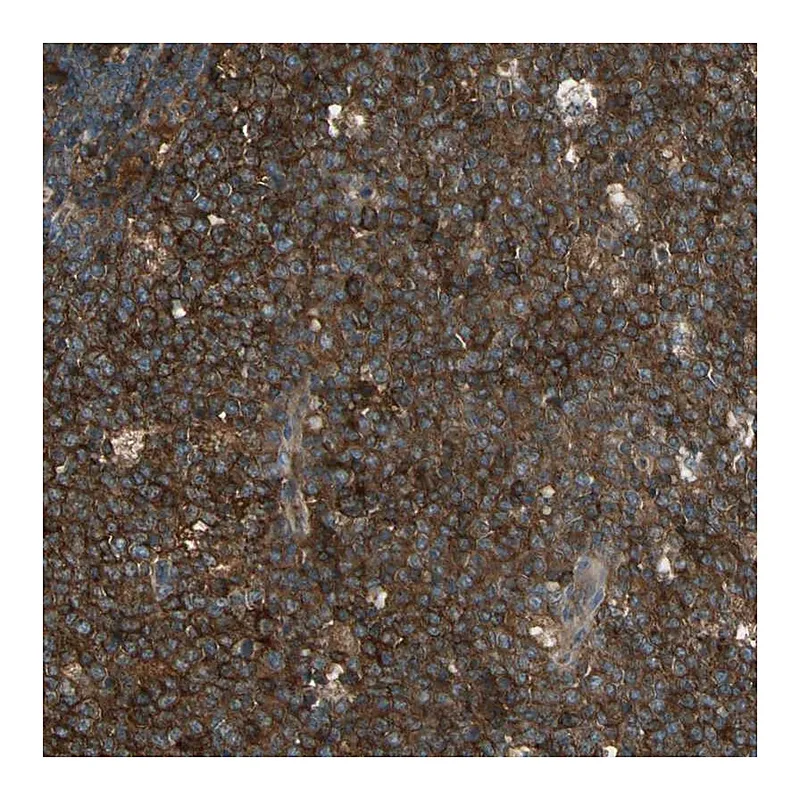 Atlas Antibodies Anti-STX11 Antibody