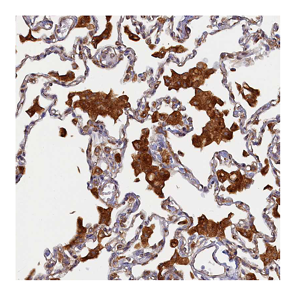 Atlas Antibodies Anti-STX12 Antibody