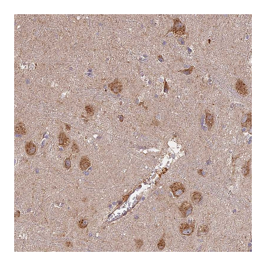 Atlas Antibodies Anti-STX16 Antibody