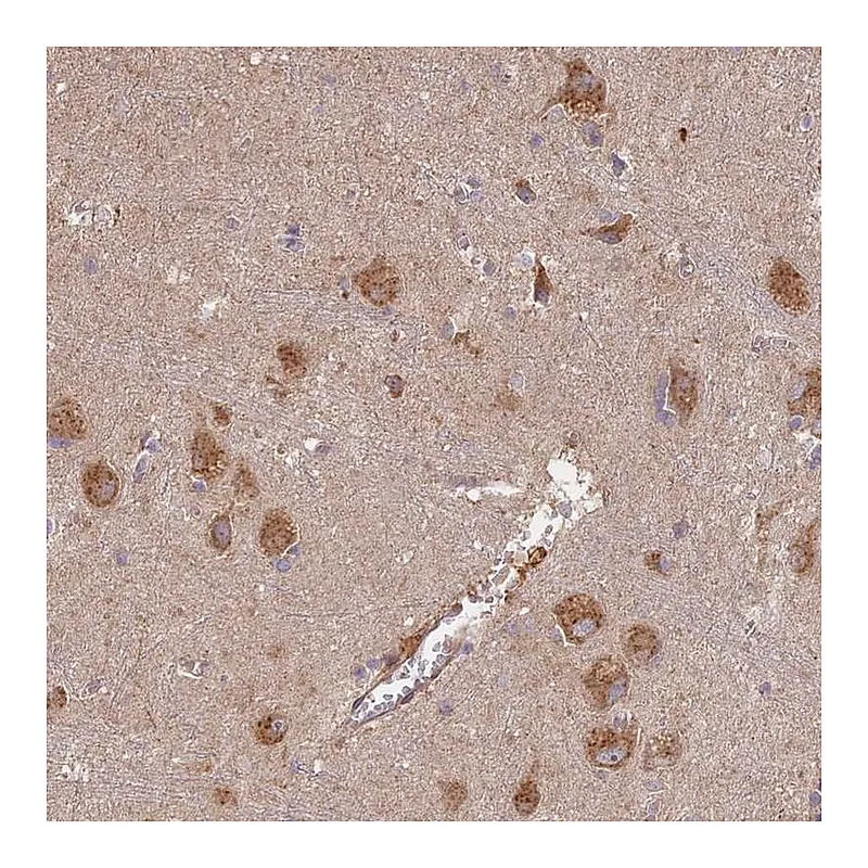 Atlas Antibodies Anti-STX16 Antibody