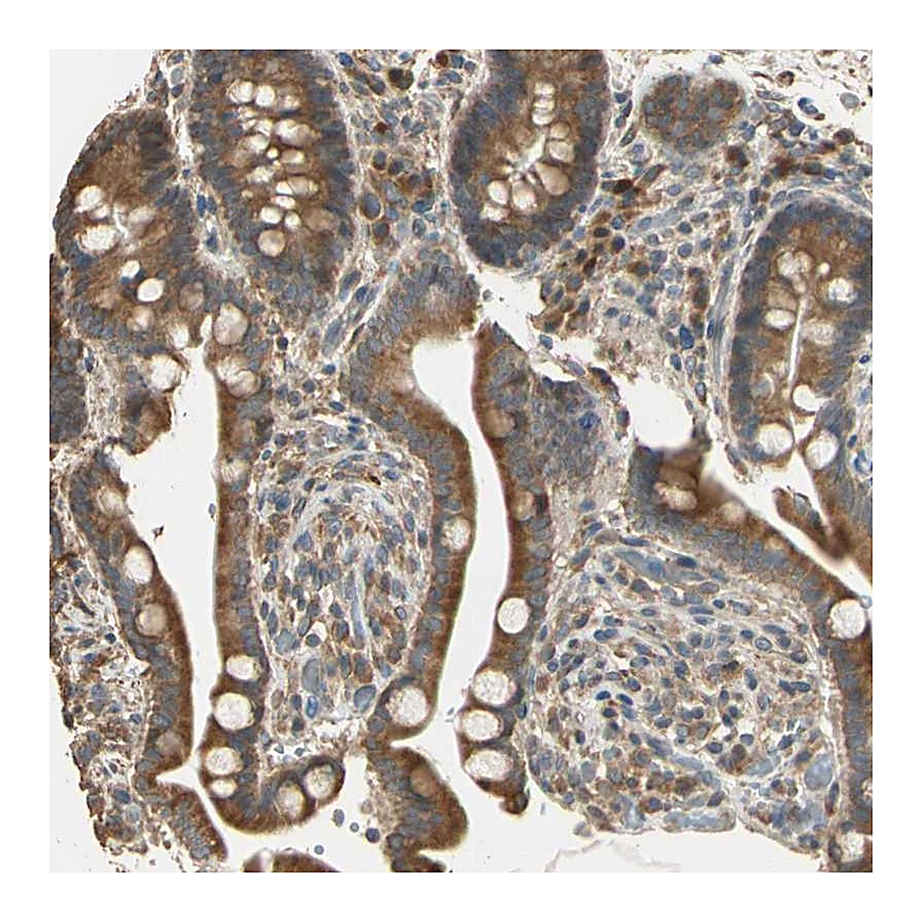 Atlas Antibodies Anti-STX18 Antibody