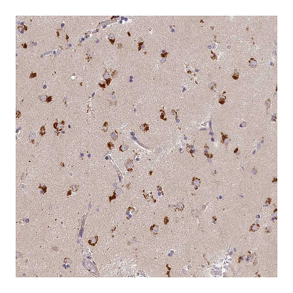 Atlas Antibodies Anti-STX16 Antibody