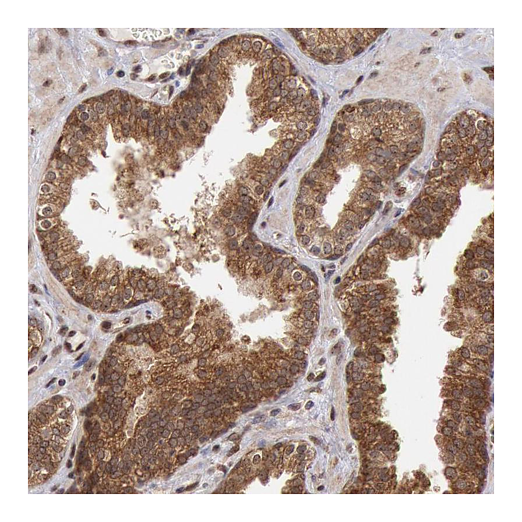 Atlas Antibodies Anti-STX17 Antibody