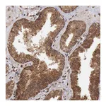 Atlas Antibodies Anti-STX17 Antibody