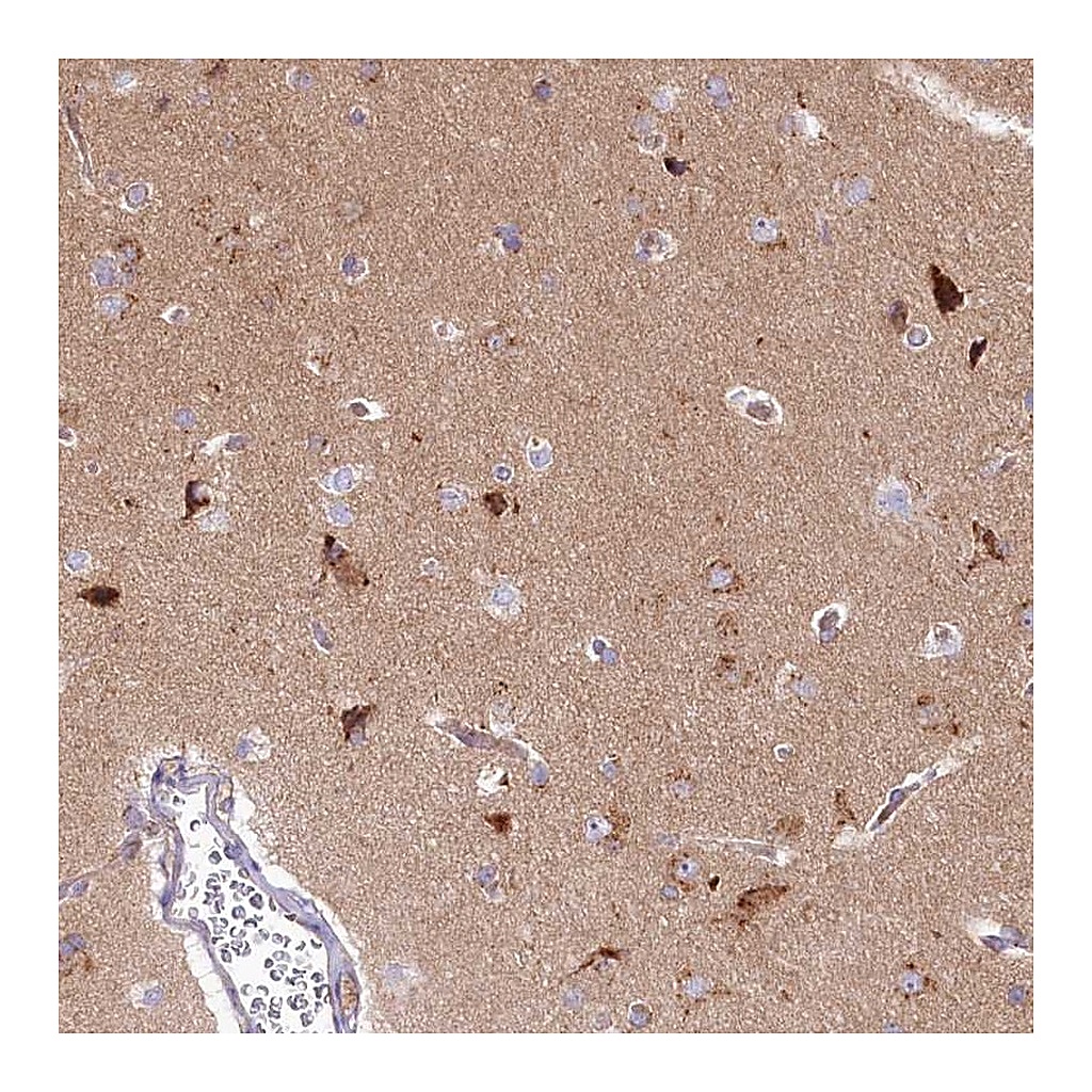 Atlas Antibodies Anti-STX6 Antibody