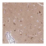 Atlas Antibodies Anti-STX6 Antibody