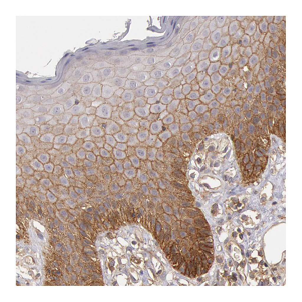 Atlas Antibodies Anti-STX4 Antibody