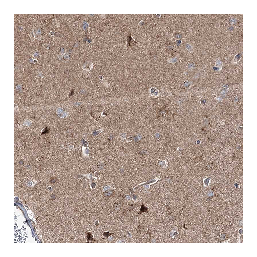 Atlas Antibodies Anti-STX6 Antibody