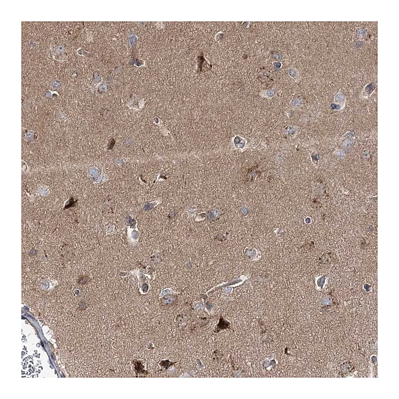Atlas Antibodies Anti-STX6 Antibody