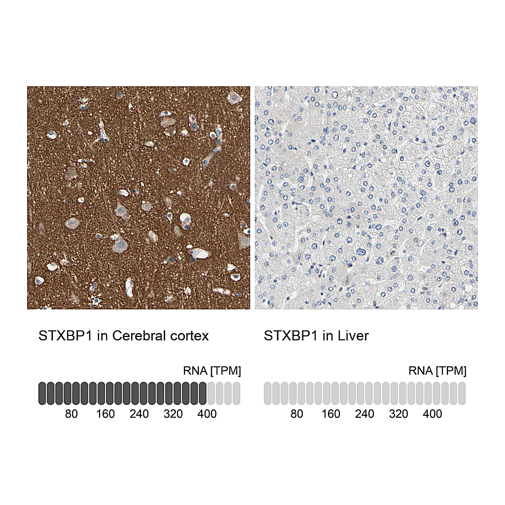 Atlas Antibodies Anti-STXBP1 Antibody