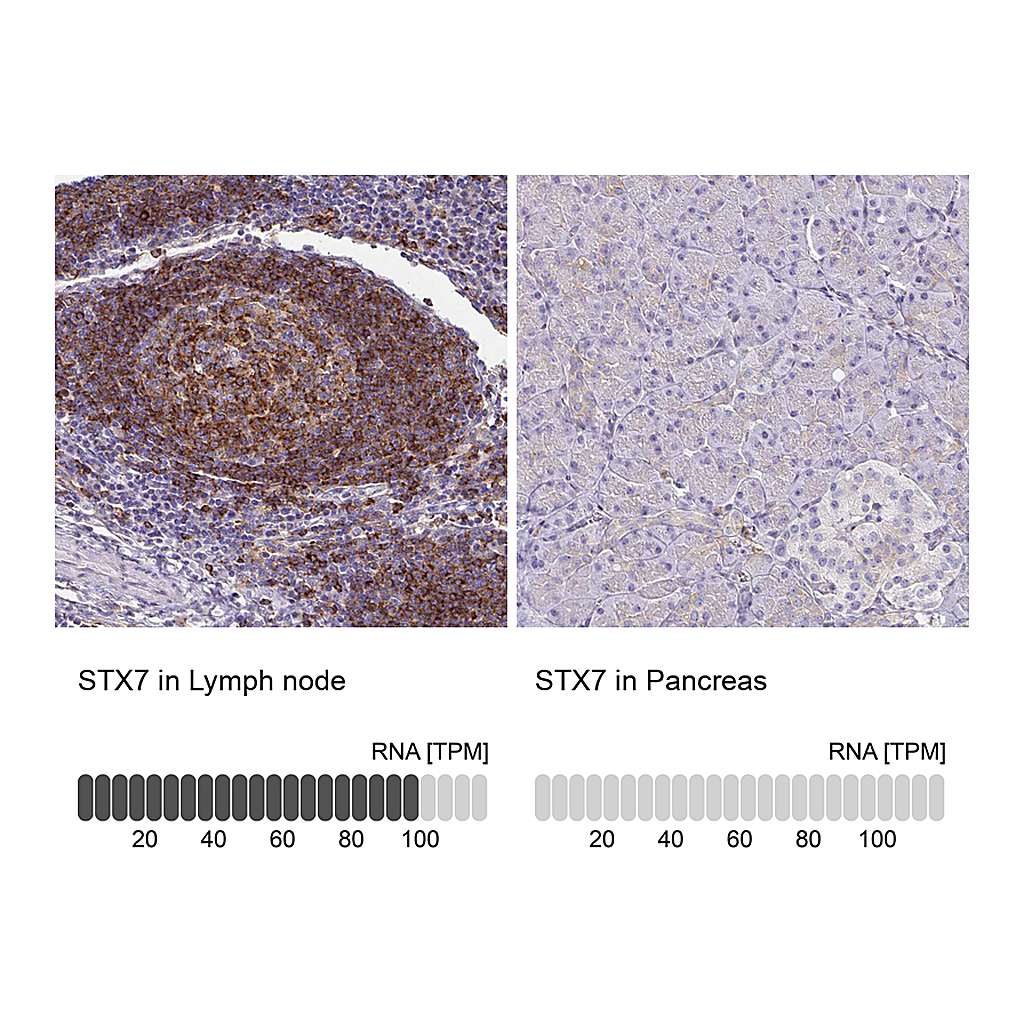 Atlas Antibodies Anti-STX7 Antibody