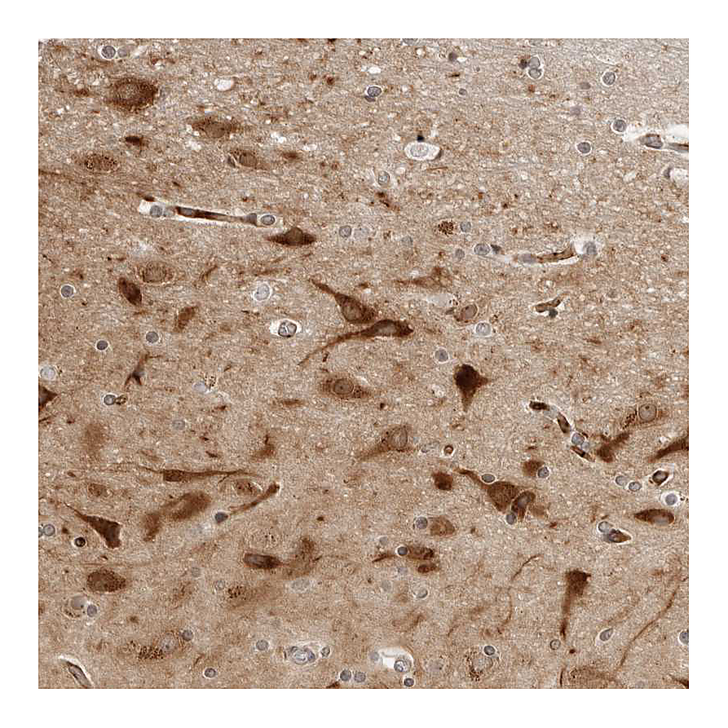 Atlas Antibodies Anti-STXBP3 Antibody