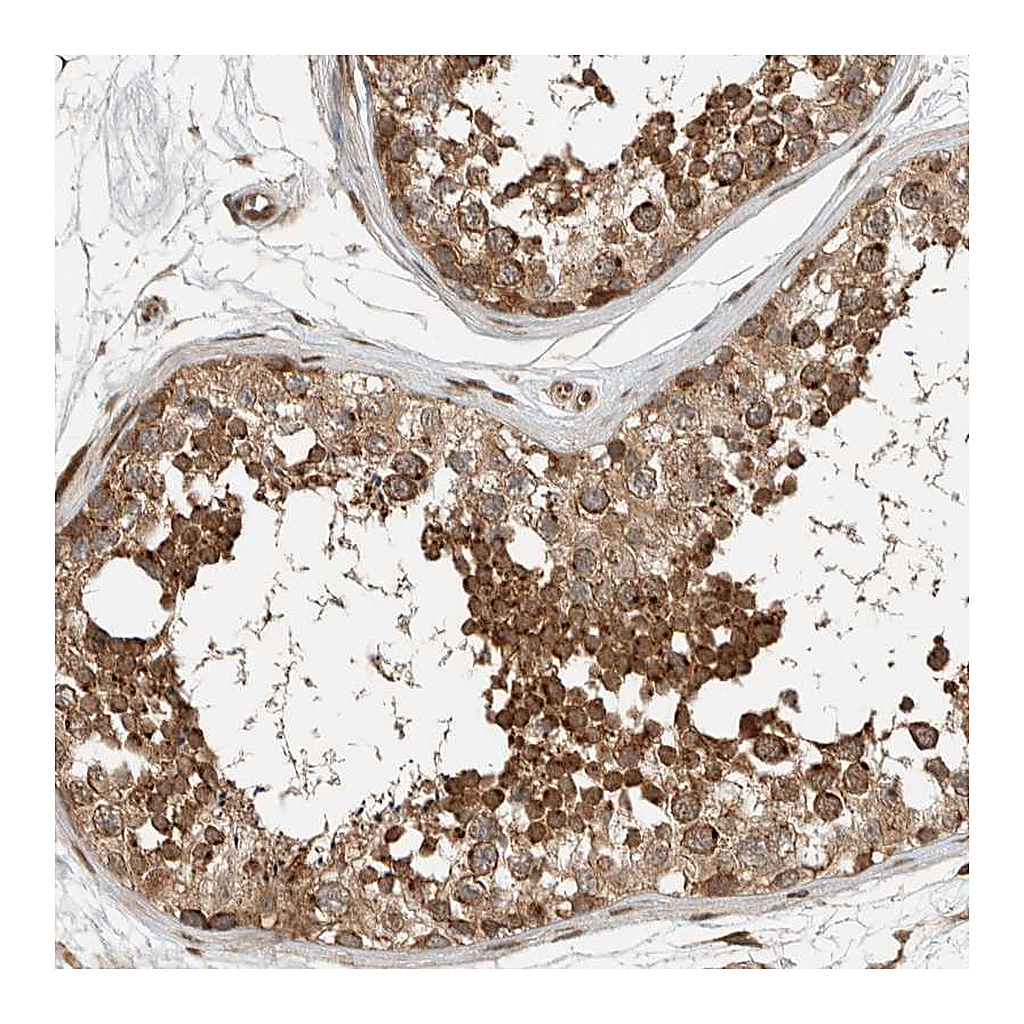 Atlas Antibodies Anti-STXBP4 Antibody