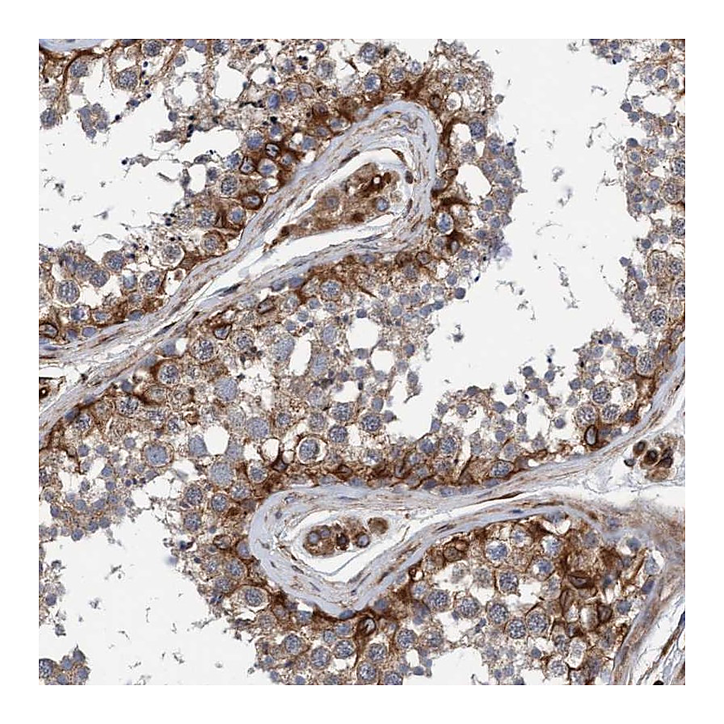 Atlas Antibodies Anti-STXBP4 Antibody