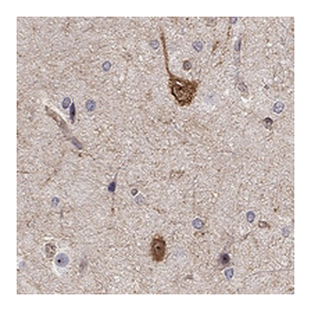 Atlas Antibodies Anti-STXBP6 Antibody