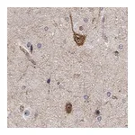 Atlas Antibodies Anti-STXBP6 Antibody
