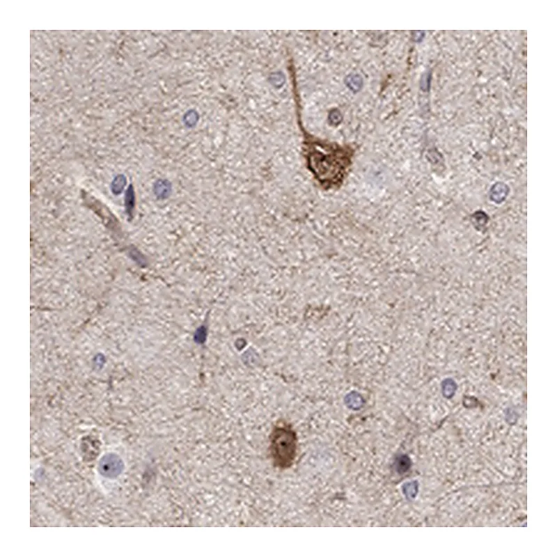 Atlas Antibodies Anti-STXBP6 Antibody