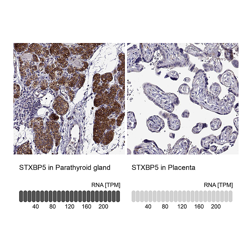 Atlas Antibodies Anti-STXBP5 Antibody