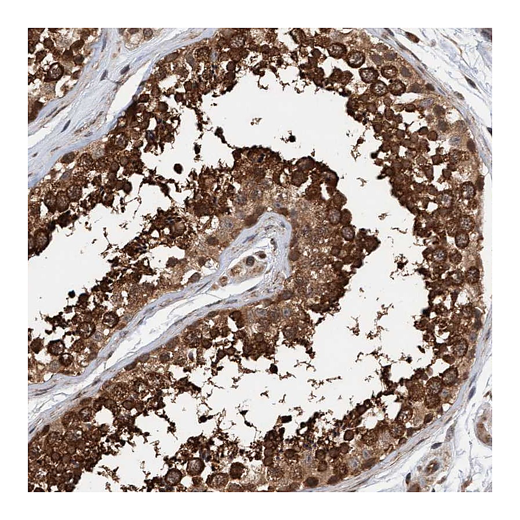 Atlas Antibodies Anti-STXBP4 Antibody