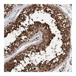 Atlas Antibodies Anti-STXBP4 Antibody