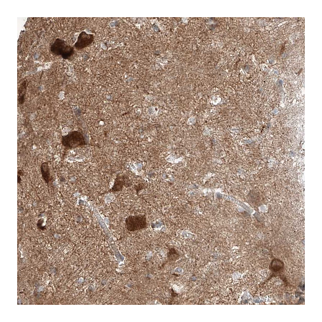 Atlas Antibodies Anti-STXBP6 Antibody