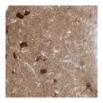 Atlas Antibodies Anti-STXBP6 Antibody