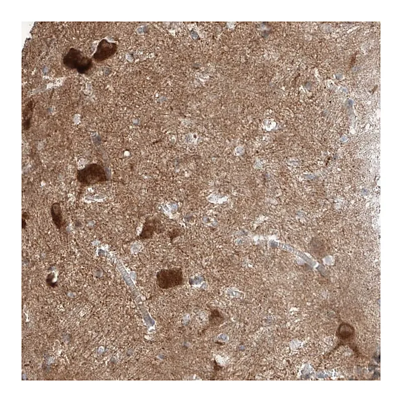 Atlas Antibodies Anti-STXBP6 Antibody