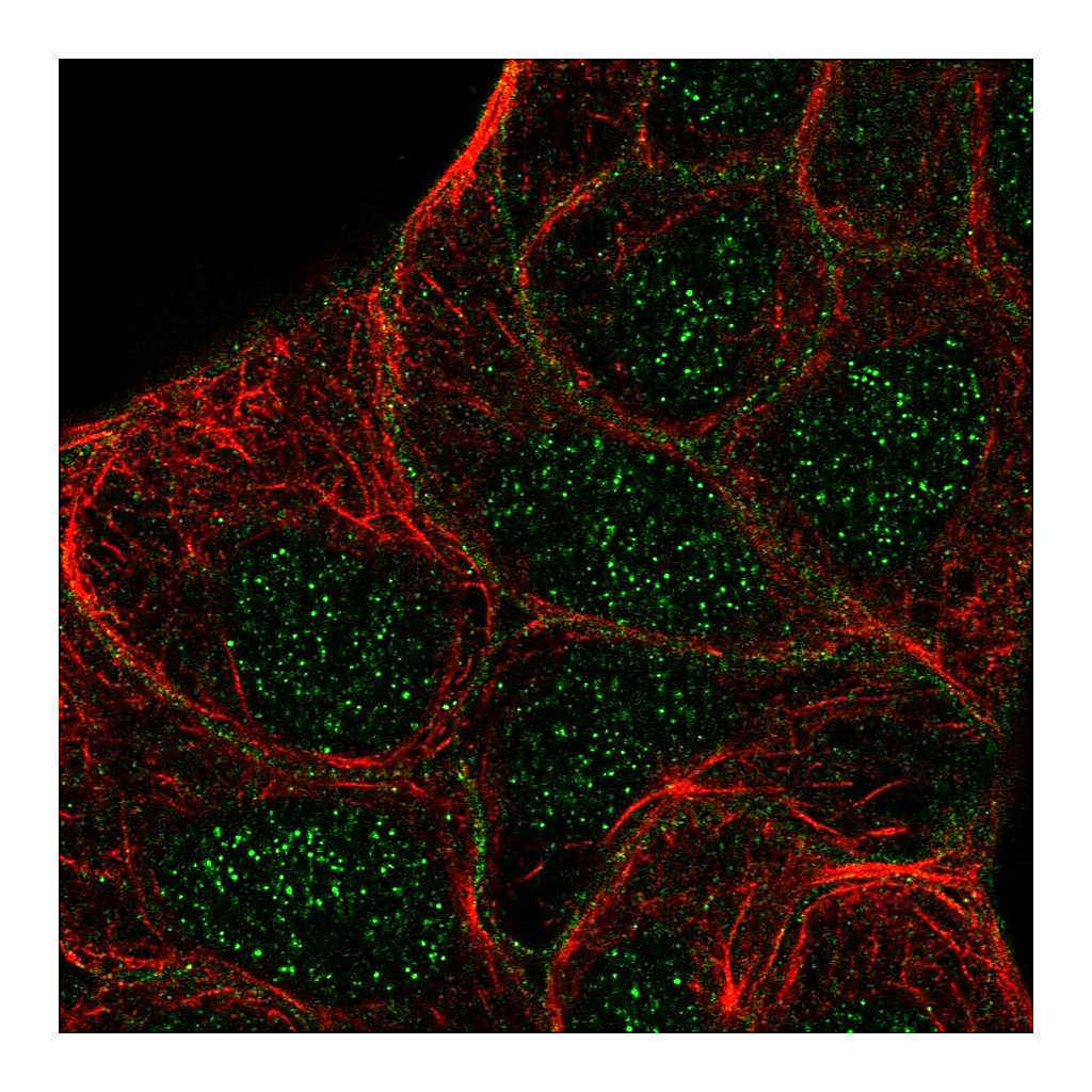 Atlas Antibodies Anti-STYK1 Antibody