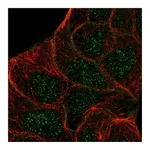 Atlas Antibodies Anti-STYK1 Antibody