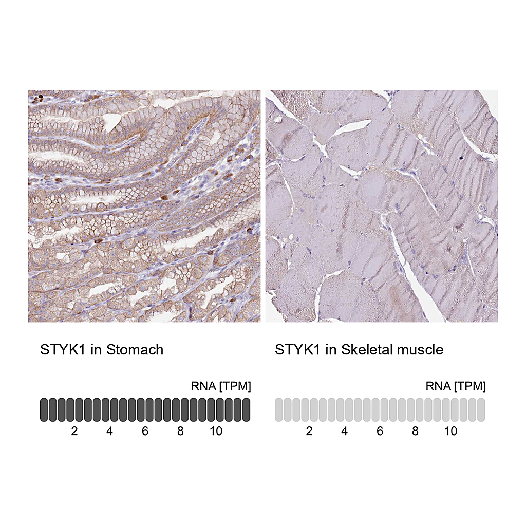 Atlas Antibodies Anti-STYK1 Antibody