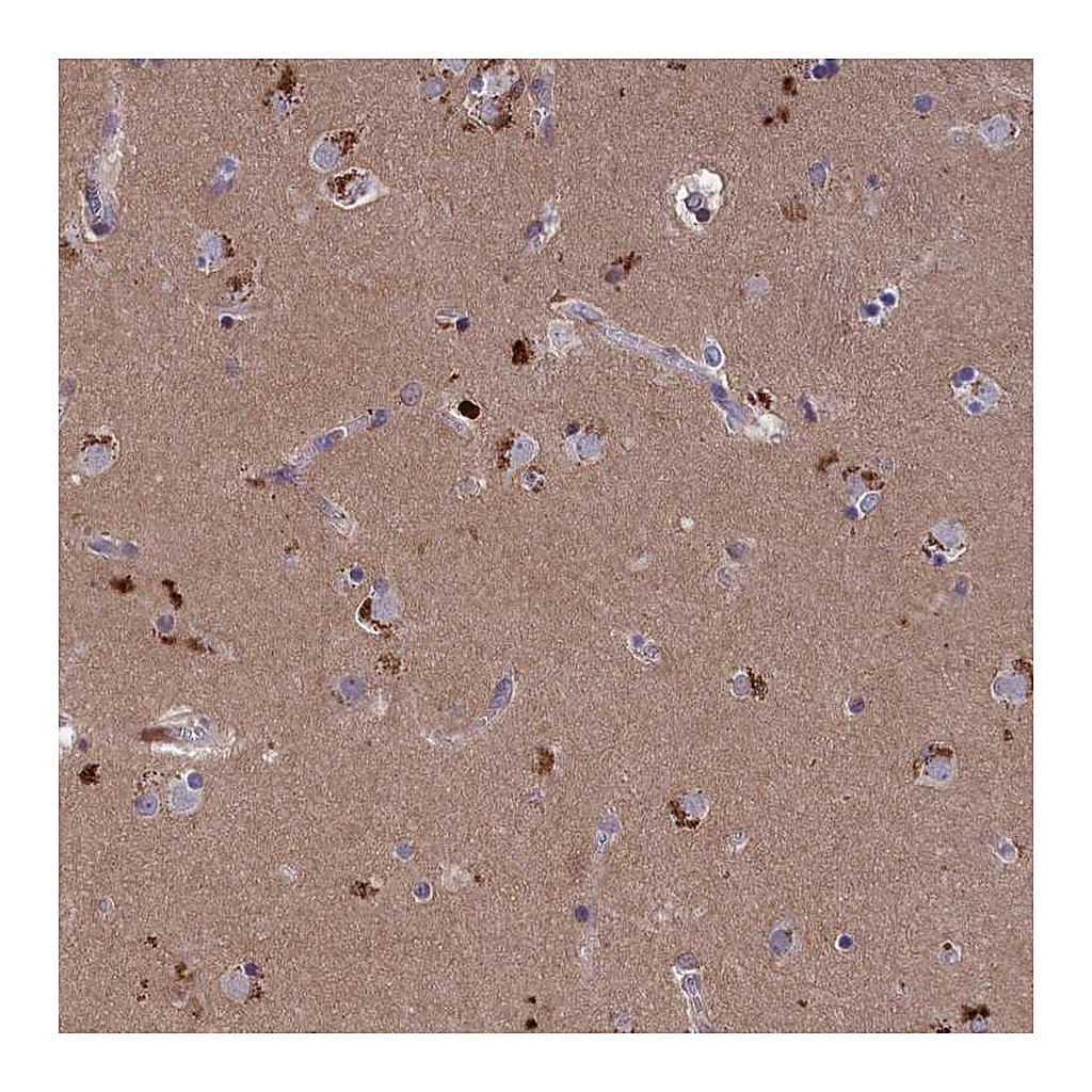 Atlas Antibodies Anti-STYX Antibody