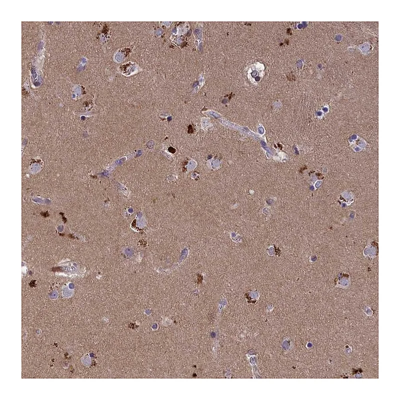Atlas Antibodies Anti-STYX Antibody